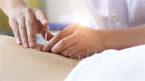 Medicare might cover acupuncture treatments for lower back pain- McKnight's Long-Term Care News