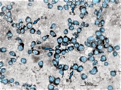 Microscopy Analyses Reveal the Parasitism of Entamoeba gingivalis in ...