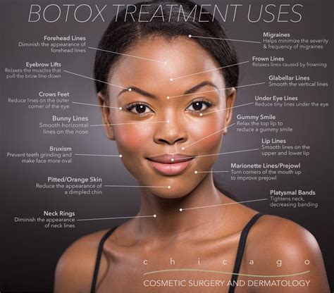 Free Printable Botox Face Chart