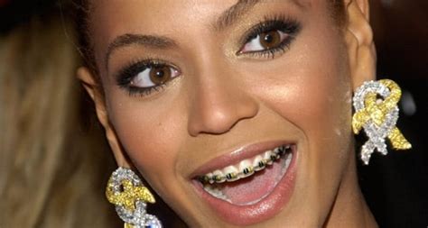 Check Out Famous People With Braces