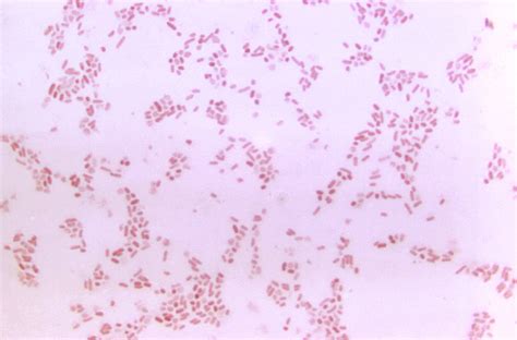 Bacteroides | Concise Medical Knowledge