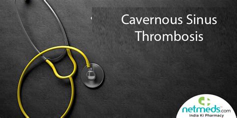 Cavernous Sinus Thrombosis: Causes, Symptoms And Treatment