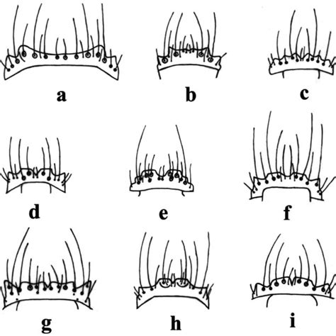 Dorsal view of the labrum of: a) Thyreocephalus unicolor, b) T. sp.... | Download Scientific Diagram