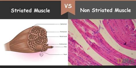 Non Striated Voluntary Muscle