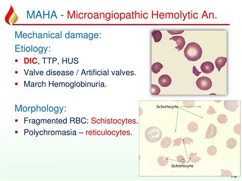 PPT - Anemia3 Hemolytic acquired PowerPoint Presentation, free download ...