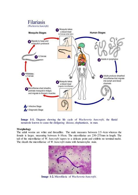 Classification of Microfilaria