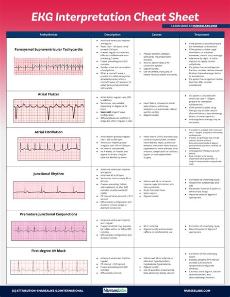 EKG Interpretation Cheat Sheet & Heart Arrhythmias Guide (2020 Update ...