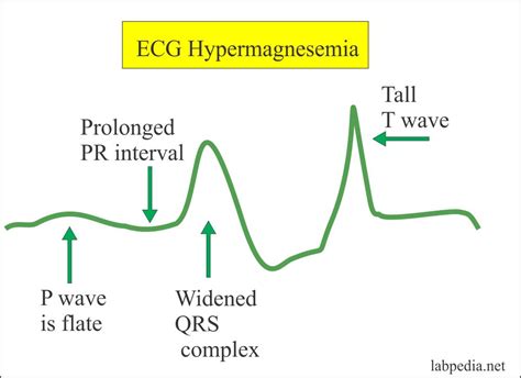 Magnesium level (Mg) – Labpedia.net