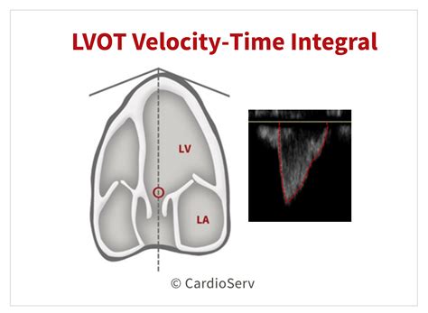 Aortic Stenosis: Breaking Down the Continuity Equation Cardioserv