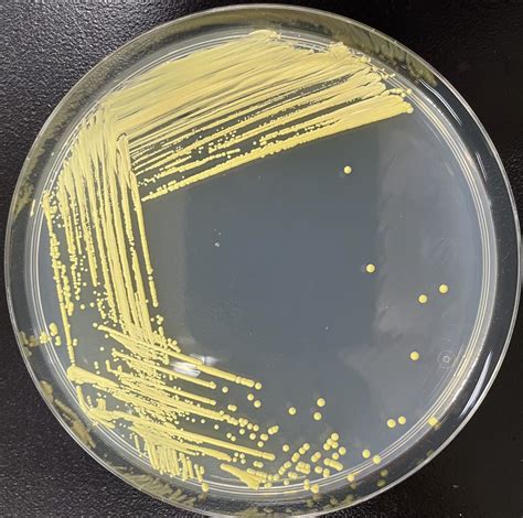 Agar Slant Tube Culture Of Kocuria Rhizophila (Micrococcus, 55% OFF