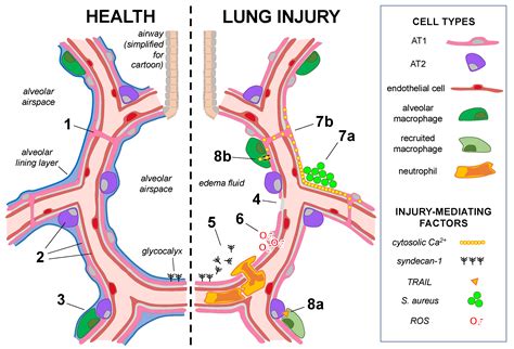 The Alveolar Epithelium at Homeostasis | Encyclopedia MDPI