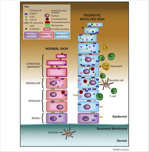 pustular psoriasis treatment - pictures, photos