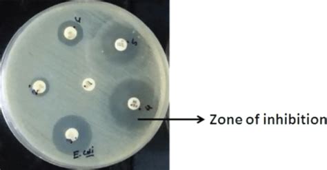 Antibiotic susceptibility test. Clear zones around the bacterial colony ...