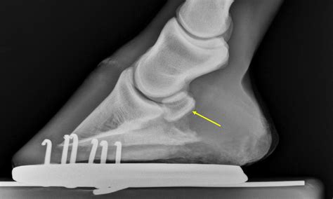 Severe Navicular Disease in a Horse