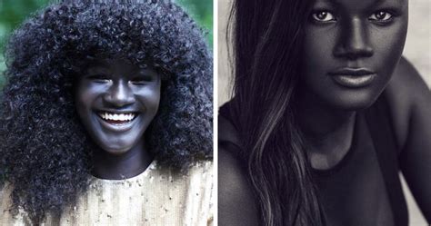 Teen Bullied For Her Incredibly Dark Skin Color Becomes A Model, Takes ...