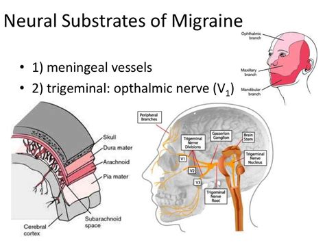 Pathophysiology: Migraine & Headache