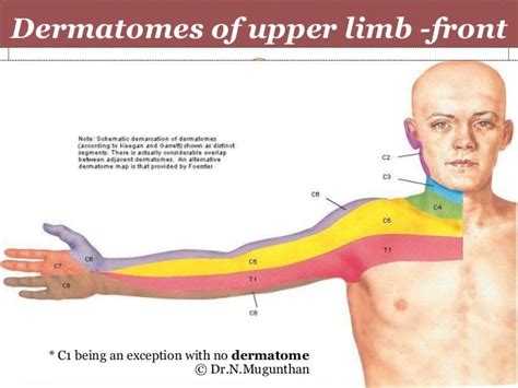 Dermatomes Upper Limb Google Search Work Diagrmas