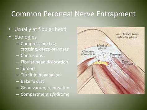 PPT - Nerve Entrapments in Runners PowerPoint Presentation, free download - ID:4539042