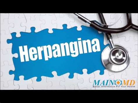 Herpangina ¦ Treatment and Symptoms - YouTube