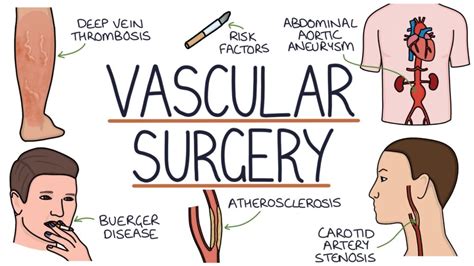 Vascular Surgery – Zero To Finals