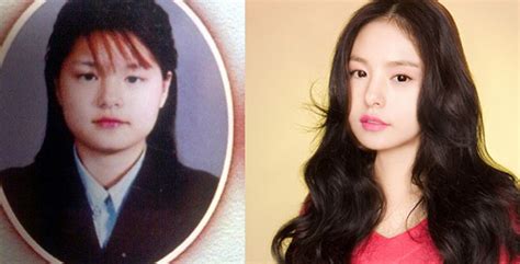 More Korean Actresses Plastic Surgery Before After Pictures – Those Who Have Admitted (Part One ...