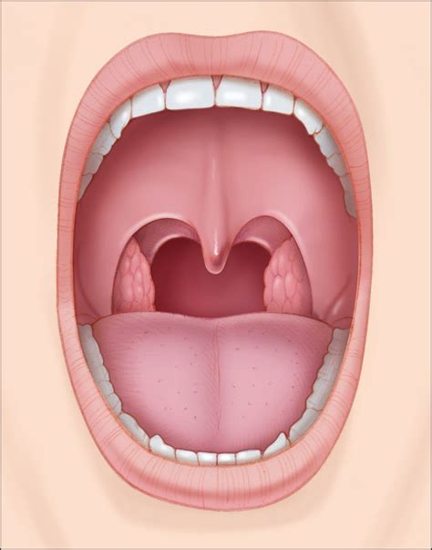 Palate Surgery - Tonsillectomy | Stanford Health Care