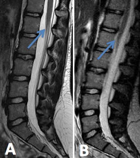 Magnetic resonance imaging in the prone position and the diagnosis of ...