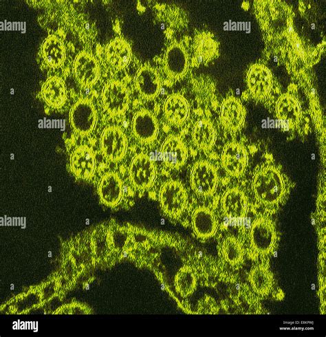 Swine Flu Virus Microscope Stock Photos & Swine Flu Virus Microscope Stock Images - Alamy
