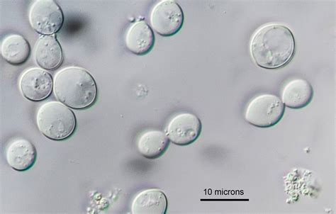 Yeast Cells Under Microscope 40x