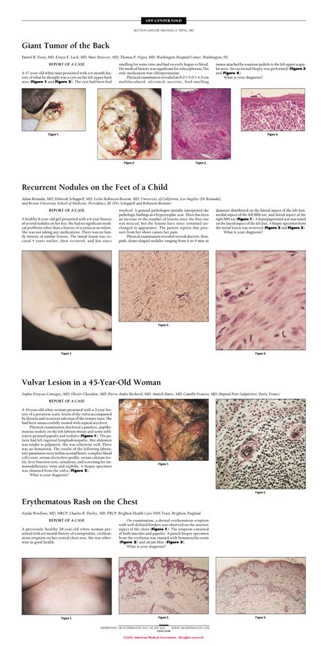 Vulvar Lesion in a 45-Year-Old Woman | Allergy and Clinical Immunology ...