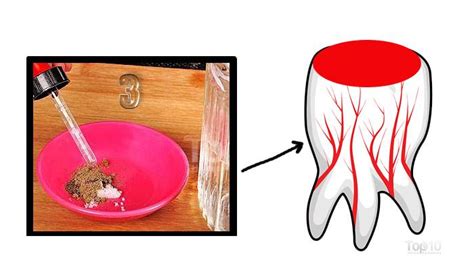 Home Remedies for Toothache that Work | Top 10 Home Remedies