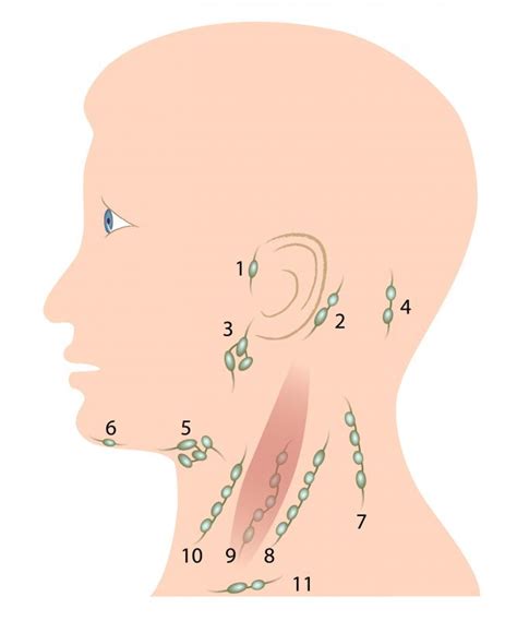 Chronic Sore Throat And Swollen Glands Cancer