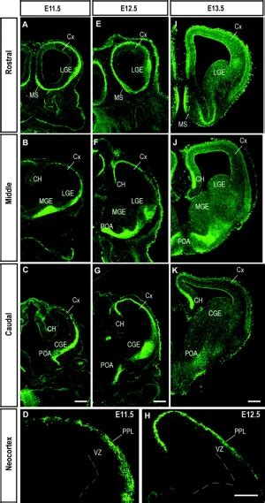 Neural - Prosencephalon Development - Embryology