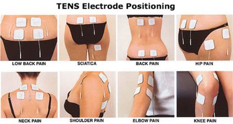 Do TENS Units Work?