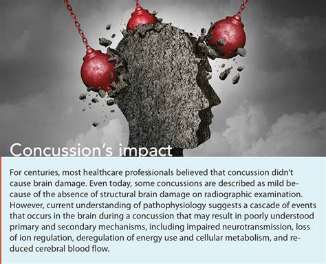 Concussion: Prevention, assessment, and management