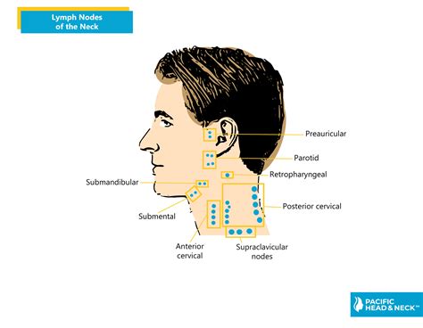 Swollen Lymph Nodes On Head