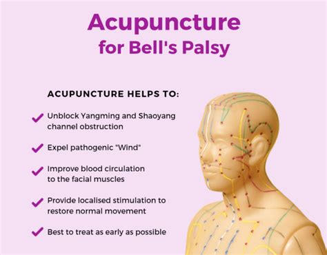 Rawatan Bell S Palsy In 2021 Facial Nerve Bells Palsy - vrogue.co