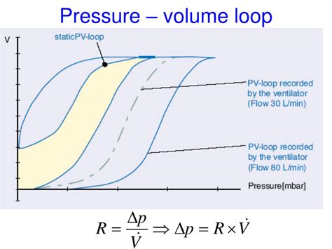 PPT - Interpretation of Ventilator Graphics PowerPoint Presentation - ID:232693