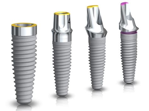 Nobel Biocare Announces Next-Gen Implant System in Madrid - iData Research