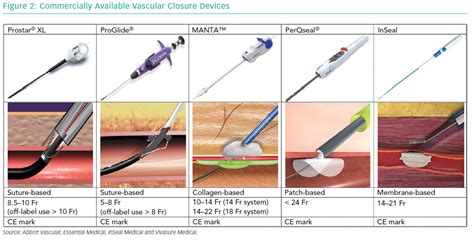 Commercially Available Vascular Closure Devices | Radcliffe Cardiology