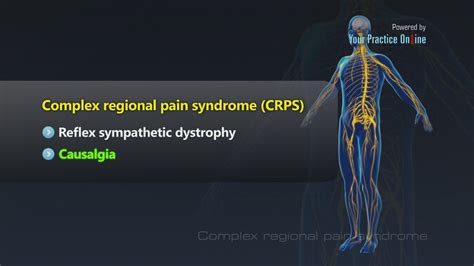 Complex Regional Pain Syndrome Video | Causes & Symptoms