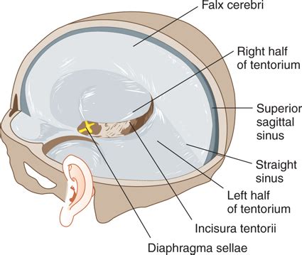 Ventricles and Coverings of the Brain | Neupsy Key