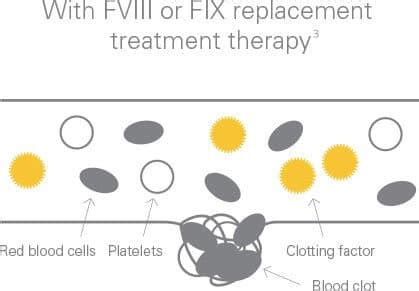 What are hemophilia inhibitors? FEIBA [Anti-Inhibitor Coagulant Complex]