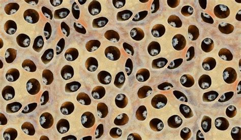 What is Trypophobia? | Trypophobia, Pimples, Blackheads