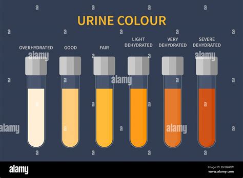 Urine color chart illustration of dehydration level Stock Vector Image & Art - Alamy