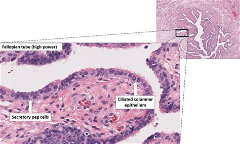 Fallopian tube– Normal Histology – NUS Pathweb :: NUS Pathweb