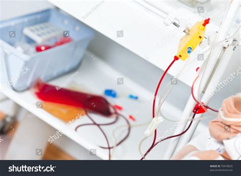 Plasmapheresis Procedure Cleaning Blood Stock Photo 75918025 - Shutterstock