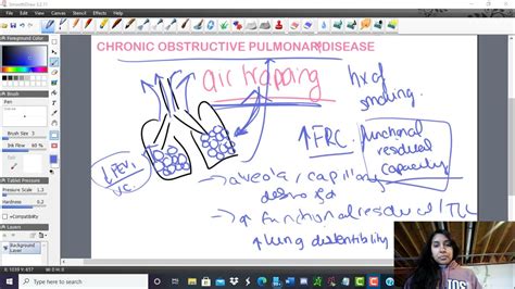 Air Trapping in COPD - YouTube