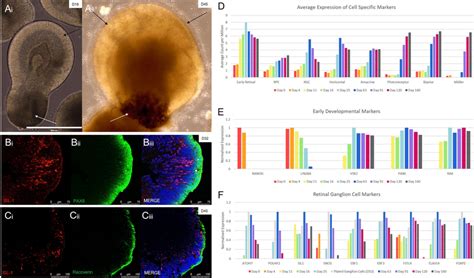 Confirmation of retinal organoid development. (Ai-ii) Whole organoids ...