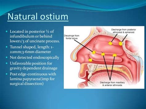 Surgical anatomy of maxillary sinus – note on (2)